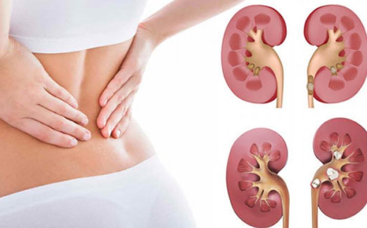 Рауф Нагиев: Для своевременного выявления мочекаменной болезни у детей важно ежегодно проходить диспансерные осмотры 