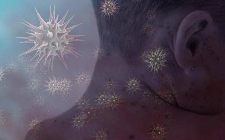 "COVİD-19"dan sonra yeni virus yayılır - Hər 3 nəfərdən birini öldürür 