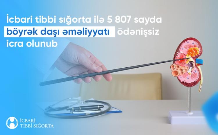 Böyrək daşlarının kəsiksiz xaric edilməsi icbari tibbi sığortaya daxildir 