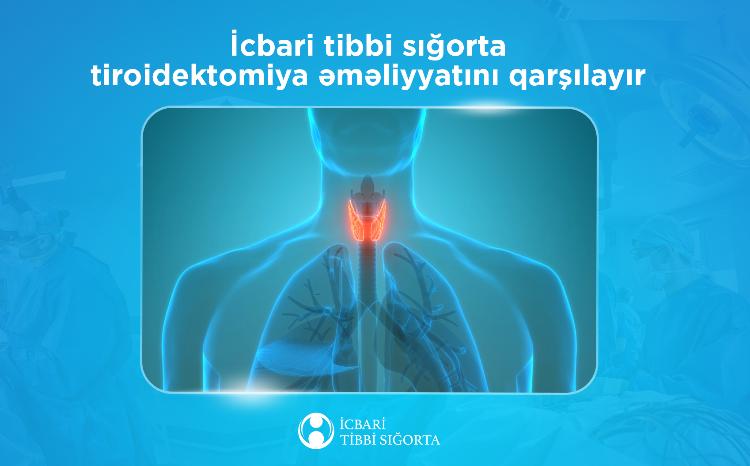 Tiroidektomiya əməliyyatı icbari tibbi sığorta ilə ödənişsizdir 