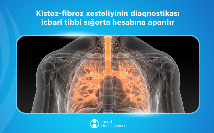 Kistoz-fibroz xəstəliyinin diaqnostikası icbari tibbi sığorta hesabına aparılır 